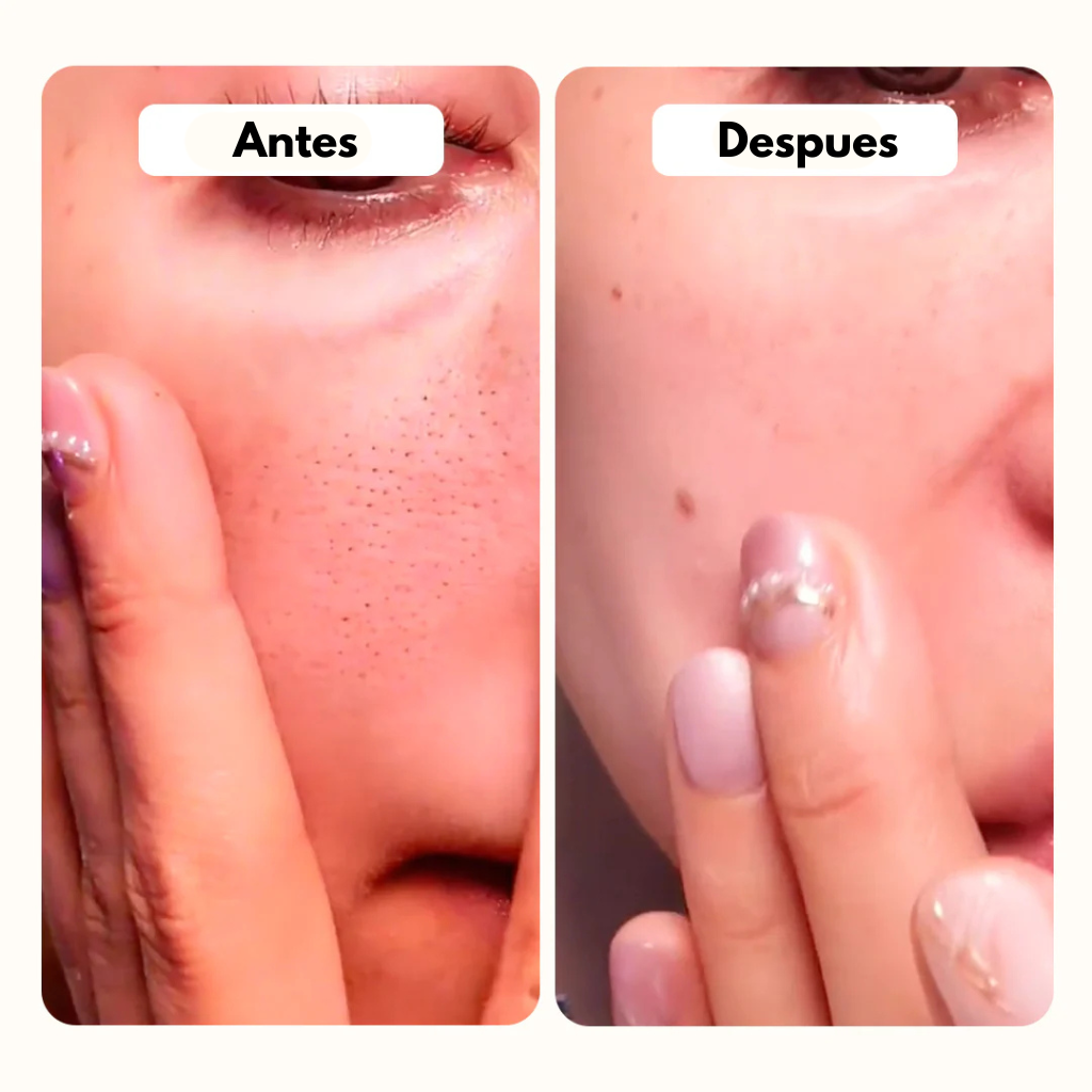 Dúo Exfoliante de Arroz 2 Pasos | Elimina Puntos Negros y Reduce Poros